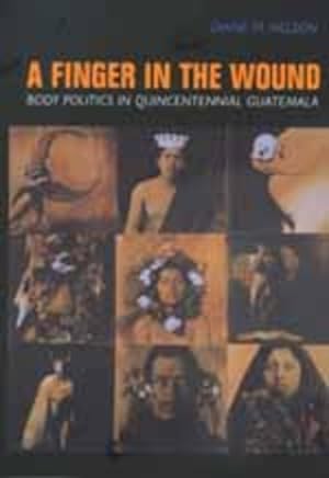 Seller image for Finger in the Wound : Body Politics in Quincentennial Guatemala for sale by GreatBookPrices