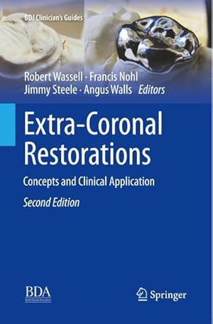 Seller image for Extra-Coronal Restorations : Concepts and Clinical Application for sale by AHA-BUCH GmbH