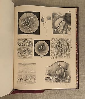 Imagen del vendedor de Atlas of the Pathological Anatomy of the Eyeball. With Thirty-Eight Plates Engraved on Copper. a la venta por Dark and Stormy Night Books