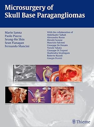 Bild des Verkufers fr Microsurgery of Skull Base Paragangliomas zum Verkauf von moluna