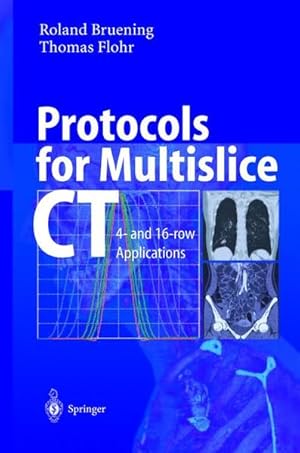 Protocols for Multislice CT: 4- and 16-row Applications.