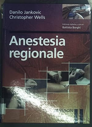 Anestesia regionale.