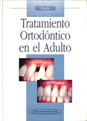 Immagine del venditore per TRATAMIENTO ORTODONTICO EN EL ADULTO. venduto da Librera Smile Books