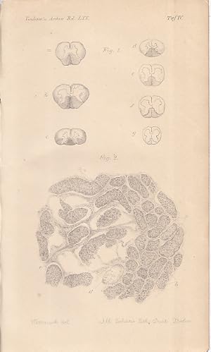 Seller image for Ueber Ataxie mit besonderere Bercksichtigung der hereditren Formen [= Nachtrag]. IN: Virchows Arch. path. Anat., 77, S. 140-52, 1877, Br. for sale by Antiquariat Michael Eschmann