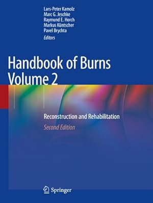Image du vendeur pour Handbook of Burns Volume 2 : Reconstruction and Rehabilitation mis en vente par AHA-BUCH GmbH