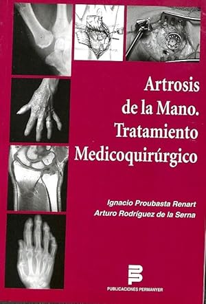 Seller image for ARTROSIS DE LA MANO. TRATAMIENTO MDICO QUIRRGICO for sale by Librera Smile Books