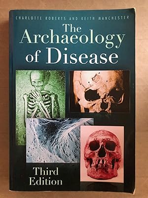 The archaeology of disease