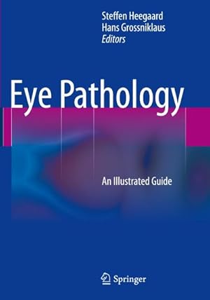 Immagine del venditore per Eye Pathology : An Illustrated Guide venduto da AHA-BUCH GmbH