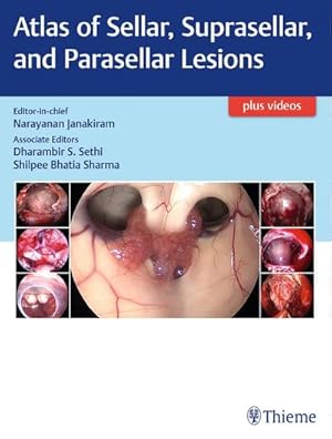 Seller image for Atlas of Sellar, Suprasellar, and Parasellar Lesions for sale by AHA-BUCH GmbH