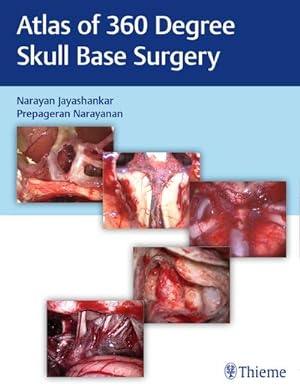 Seller image for Atlas of 360 Degree Skull Base Surgery for sale by Rheinberg-Buch Andreas Meier eK