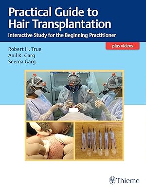 Seller image for Practical Guide to Hair Transplantation - Interactive Study for the Beginning Practitioner for sale by moluna