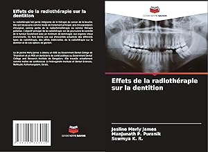 Seller image for Effets de la radiothrapie sur la dentition for sale by moluna