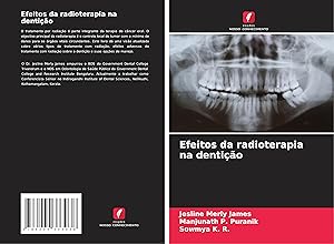 Seller image for Efeitos da radioterapia na dentio for sale by moluna
