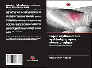Bild des Verkufers fr Lupus rythmateux systmique, aperu stomatologique zum Verkauf von moluna