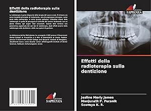 Seller image for Effetti della radioterapia sulla dentizione for sale by moluna