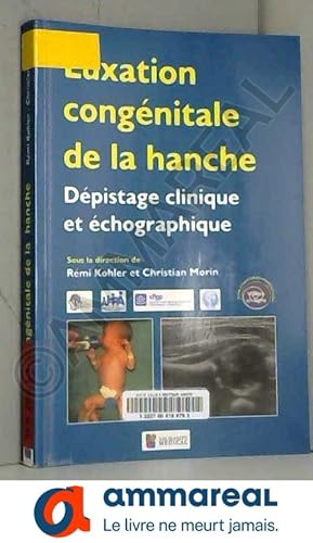 Image du vendeur pour Luxation congnitale de la hanche: Dpistage clinique et chographique mis en vente par Ammareal