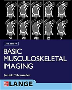 Bild des Verkufers fr Basic Musculoskeletal Imaging, Second Edition by Tehranzadeh, Jamshid [Paperback ] zum Verkauf von booksXpress
