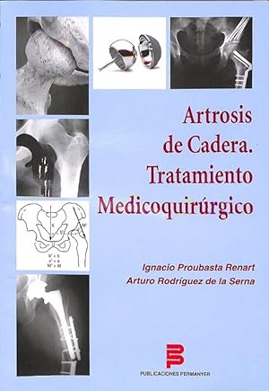 Seller image for ARTROSIS DE CADERA. TRATAMIENTO MEDICOQUIRRGICO for sale by Librera Smile Books