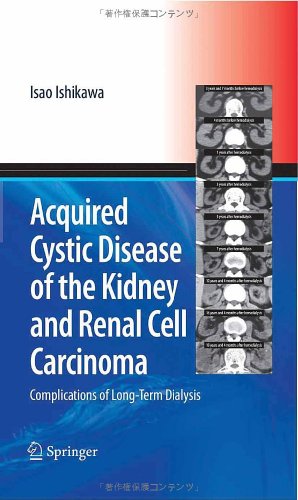Image du vendeur pour Acquired Cystic Disease of the Kidney and Renal Cell Carcinoma: Complication of Long-Term Dialysis by Ishikawa, Isao [Hardcover ] mis en vente par booksXpress