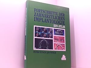 Fortschritte der zahnärztlichen Implantologie: Ein Atlas