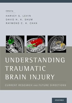 Image du vendeur pour Understanding Traumatic Brain Injury : Current Research and Future Directions mis en vente par GreatBookPrices