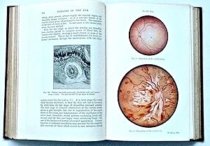 Seller image for DISEASES OF THE EYE (1948 11th ed) for sale by Roger Godden