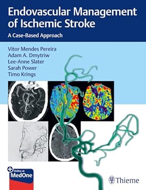 Seller image for Endovascular Management of Ischemic Stroke : A Case-Based Approach for sale by GreatBookPricesUK
