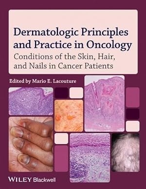 Seller image for Dermatologic Principles and Practice in Oncology for sale by moluna