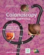 Seller image for Colonoscopy for sale by moluna