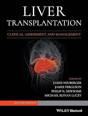 Seller image for Liver Transplantation for sale by moluna