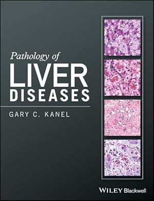 Seller image for Pathology of Liver Diseases for sale by moluna