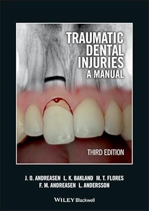 Bild des Verkufers fr Traumatic Dental Injuries zum Verkauf von moluna