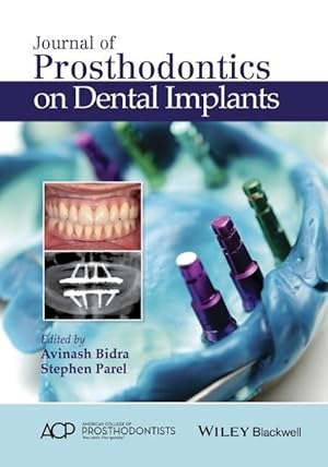 Bild des Verkufers fr Journal of Prosthodontics on Dental Implants zum Verkauf von moluna