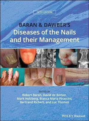 Seller image for Baran and Dawber\ s Diseases of the Nails and their Management for sale by moluna