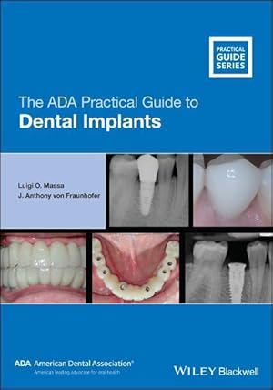 Image du vendeur pour ADA Practical Guide to Dental Implants mis en vente par moluna