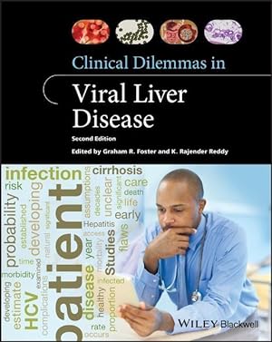 Seller image for Clinical Dilemmas in Viral Liver Disease for sale by moluna