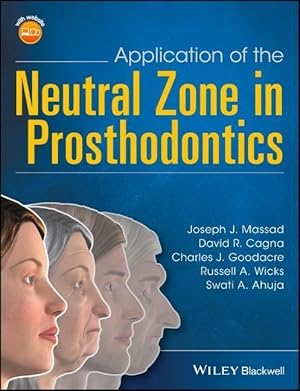 Bild des Verkufers fr Application of the Neutral Zone in Prosthodontics zum Verkauf von moluna