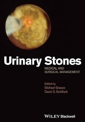 Seller image for Urinary Stones for sale by moluna