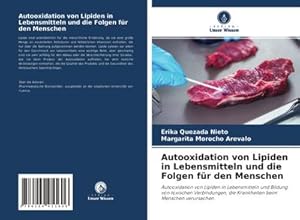 Seller image for Autooxidation von Lipiden in Lebensmitteln und die Folgen fr den Menschen : Autooxidation von Lipiden in Lebensmitteln und Bildung von toxischen Verbindungen, die Krankheiten beim Menschen verursachen for sale by AHA-BUCH GmbH