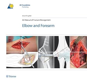 Bild des Verkufers fr AO Manual of Fracture Management : Elbow and Forearm zum Verkauf von GreatBookPricesUK