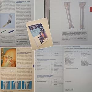 Immagine del venditore per Kniegelenknahe Osteotomien. Indikation - Planung - Operationstechniken mit Plattenfixateurene venduto da Galerie fr gegenstndliche Kunst