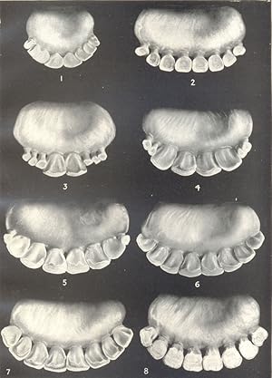 Age of Animals-II. Dentition of the Ox; 1. Incisors at one month; 2. Incisors of Steer, one year;...