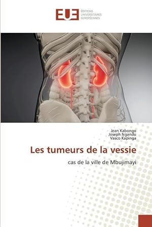 Seller image for Les tumeurs de la vessie for sale by moluna