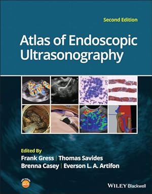 Bild des Verkufers fr Atlas of Endoscopic Ultrasonography zum Verkauf von GreatBookPrices