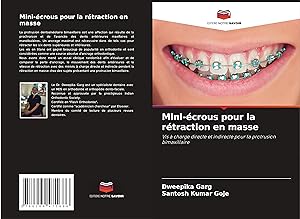 Seller image for Mini-crous pour la rtraction en masse for sale by moluna