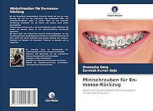 Seller image for Minischrauben fr En-masse-Rckzug for sale by moluna