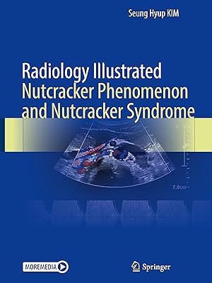 Immagine del venditore per Radiology Illustrated: Nutcracker Phenomenon and Nutcracker Syndrome venduto da moluna