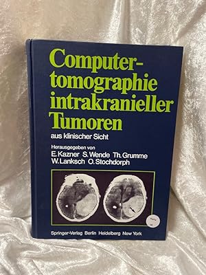 Seller image for Computertomographie intrakranieller Tumoren aus klinischer Sicht (German Edition) hrsg. von E. Kazner . Bearb. von G. B. Brada  . for sale by Antiquariat Jochen Mohr -Books and Mohr-