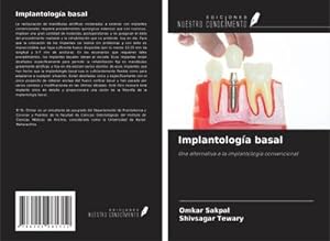 Seller image for Implantologa basal : Una alternativa a la implantologa convencional for sale by AHA-BUCH GmbH