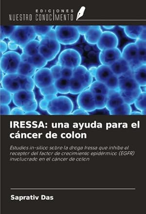 Seller image for IRESSA: una ayuda para el cncer de colon : Estudios in-silico sobre la droga Iressa que inhibe el receptor del factor de crecimiento epidrmico (EGFR) involucrado en el cncer de colon for sale by AHA-BUCH GmbH